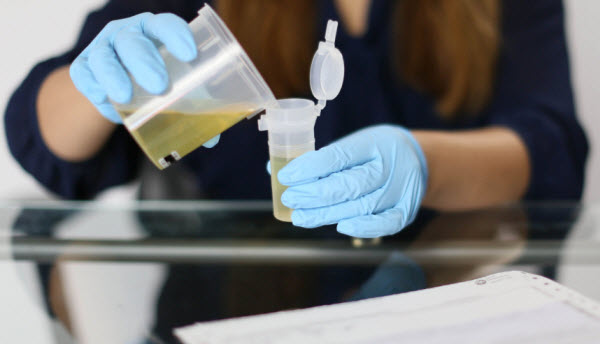 Person giving a urine test